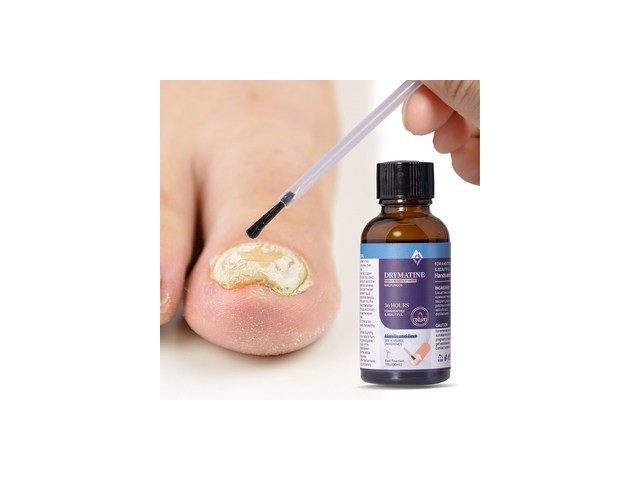 발톱무좀진균제 올해 화제의 아이템